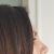 Rinoplastia Dr Lombardo