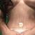 Operada el 17 de enero de 2019 Abdominoplastia con lipo cintura